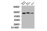 Western blot analysis of 1) Mouse Brain Tissue, 2)Rat Brain Tissue, 3)Human Brain Tissue, with CCKBR Rabbit pAb diluted at 1:2,000.