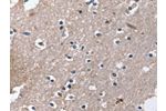The image on the left is immunohistochemistry of paraffin-embedded Human brain tissue using CSB-PA926314(DUT Antibody) at dilution 1/30, on the right is treated with synthetic peptide. (Original magnification: 