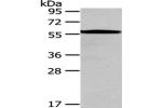 Gel: 8%SDS-PAGE,Lysate: 40 