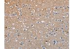 The image on the left is immunohistochemistry of paraffin-embedded Human brain tissue using CSB-PA927593(AMBRA1 Antibody) at dilution 1/50, on the right is treated with fusion protein. (Original magnification: 