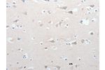 The image on the left is immunohistochemistry of paraffin-embedded Human brain tissue using CSB-PA929459(GCH1 Antibody) at dilution 1/15, on the right is treated with synthetic peptide. (Original magnification: 