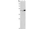 Gel: 8%SDS-PAGE, Lysate: 40 