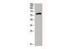 Western Blot analysis of HEPG2 cells using Antibody diluted at 500. Secondary antibody  was diluted at 1:20000