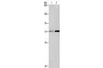 Gel: 6%SDS-PAGE, Lysate: 40 