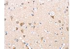 The image on the left is immunohistochemistry of paraffin-embedded Human brain tissue using CSB-PA932466(ADAM15 Antibody) at dilution 1/35, on the right is treated with fusion protein. (Original magnification: 