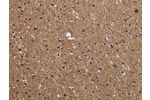 The image on the left is immunohistochemistry of paraffin-embedded Human brain tissue using CSB-PA932822(CMTM5 Antibody) at dilution 1/40, on the right is treated with synthetic peptide. (Original magnification: 