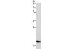 Gel: 10%SDS-PAGE, Lysate: 40 