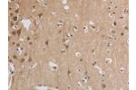 The image on the left is immunohistochemistry of paraffin-embedded Human brain tissue using CSB-PA934646(ELOVL1 Antibody) at dilution 1/30, on the right is treated with fusion protein. (Original magnification: 