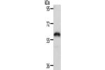 Gel: 8%SDS-PAGE, Lysate: 40 
