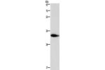 Gel: 8%SDS-PAGE,Lysate: 40 