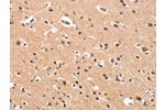 The image on the left is immunohistochemistry of paraffin-embedded Human brain tissue using CSB-PA937671(CYP46A1 Antibody) at dilution 1/15, on the right is treated with synthetic peptide. (Original magnification: 