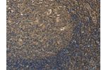 The image on the left is immunohistochemistry of paraffin-embedded Human tonsil tissue using CSB-PA938110(DDX19B Antibody) at dilution 1/20, on the right is treated with fusion protein. (Original magnification: 