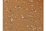 The image on the left is immunohistochemistry of paraffin-embedded Human brain tissue using CSB-PA938221(CHRNA4 Antibody) at dilution 1/40, on the right is treated with fusion protein. (Original magnification: 
