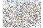 The image on the left is immunohistochemistry of paraffin-embedded Human tonsil tissue using CSB-PA938413(FAM3A Antibody) at dilution 1/25, on the right is treated with fusion protein. (Original magnification: 