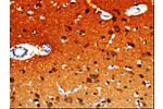 The image on the left is immunohistochemistry of paraffin-embedded Human brain tissue using CSB-PA939836(GDI1 Antibody) at dilution 1/20, on the right is treated with fusion protein. (Original magnification: 