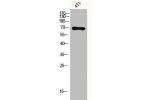 Western Blot analysis of 4T1 cells using Acetyl-Ku-70 (K331) Polyclonal Antibody
