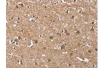 The image on the left is immunohistochemistry of paraffin-embedded Human brain tissue using CSB-PA941013(BUB1 Antibody) at dilution 1/60, on the right is treated with fusion protein. (Original magnification: 