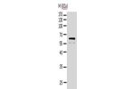 Gel: 10%SDS-PAGE, Lysate: 30 