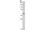 Gel: 10%SDS-PAGE, Lysate: 40 