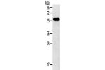 Gel: 8%SDS-PAGE, Lysate: 60 