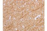 The image on the left is immunohistochemistry of paraffin-embedded Human brain tissue using CSB-PA944463(BGLAP Antibody) at dilution 1/40, on the right is treated with synthetic peptide. (Original magnification: 