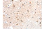 The image on the left is immunohistochemistry of paraffin-embedded Human brain tissue using CSB-PA944795(ANXA8 Antibody) at dilution 1/25, on the right is treated with fusion protein. (Original magnification: 