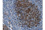 The image on the left is immunohistochemistry of paraffin-embedded Human tonsil tissue using CSB-PA951901(FCER2 Antibody) at dilution 1/40, on the right is treated with fusion protein. (Original magnification: 