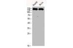 Western Blot analysis of HEPG2 Hela cells using CYFIP2 Polyclonal Antibody diluted at 1:500. Secondary antibody  was diluted at 1:20000