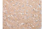The image on the left is immunohistochemistry of paraffin-embedded Human brain tissue using CSB-PA952749(COLEC12 Antibody) at dilution 1/40, on the right is treated with synthetic peptide. (Original magnification: 