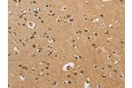 The image on the left is immunohistochemistry of paraffin-embedded Human brain tissue using CSB-PA954269(CST6 Antibody) at dilution 1/70, on the right is treated with fusion protein. (Original magnification: 