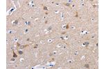 The image on the left is immunohistochemistry of paraffin-embedded Human brain tissue using CSB-PA955751(FN1 Antibody) at dilution 1/50, on the right is treated with fusion protein. (Original magnification: 