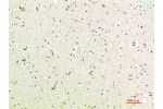 Immunohistochemical analysis of paraffin-embedded human-brain, antibody was diluted at 1:200