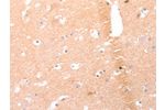 The image on the left is immunohistochemistry of paraffin-embedded Human brain tissue using CSB-PA960464(AMH Antibody) at dilution 1/25, on the right is treated with synthetic peptide. (Original magnification: 
