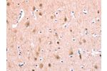 The image on the left is immunohistochemistry of paraffin-embedded Human brain tissue using CSB-PA962181(BMPR2 Antibody) at dilution 1/35, on the right is treated with fusion protein. (Original magnification: 
