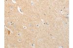 The image on the left is immunohistochemistry of paraffin-embedded Human brain tissue using CSB-PA963250(APLNR Antibody) at dilution 1/20, on the right is treated with fusion protein. (Original magnification: 