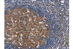 The image on the left is immunohistochemistry of paraffin-embedded Human tonsil tissue using CSB-PA966396(CEP97 Antibody) at dilution 1/40, on the right is treated with fusion protein. (Original magnification: 