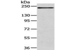 Gel: 6%SDS-PAGE,Lysate: 40 