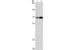 Gel: 8%SDS-PAGE, Lysate: 40 