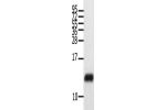Gel: 12%SDS-PAGE, Lysate: 40 