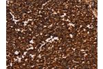 The image on the left is immunohistochemistry of paraffin-embedded Human tonsil tissue using CSB-PA976819(ALG11 Antibody) at dilution 1/40, on the right is treated with synthetic peptide. (Original magnification: 