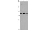 Gel: 6%SDS-PAGE, Lysate: 40 