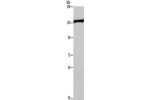 Gel: 6%SDS-PAGE, Lysate: 40 