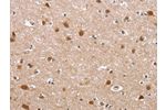The image on the left is immunohistochemistry of paraffin-embedded Human brain tissue using CSB-PA980801(DEFA6 Antibody) at dilution 1/40, on the right is treated with fusion protein. (Original magnification: 