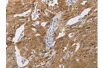 The image on the left is immunohistochemistry of paraffin-embedded Human tonsil tissue using CSB-PA981539(CEBPA Antibody) at dilution 1/40, on the right is treated with synthetic peptide. (Original magnification: 