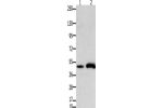 Gel: 10%SDS-PAGE, Lysate: 40 