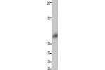 Gel: 10%SDS-PAGE, Lysate: 40 