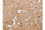 The image on the left is immunohistochemistry of paraffin-embedded Human brain tissue using CSB-PA983266(ATP2C1 Antibody) at dilution 1/50, on the right is treated with fusion protein. (Original magnification: 