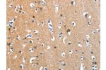 The image on the left is immunohistochemistry of paraffin-embedded Human brain tissue using CSB-PA986263(ANKMY1 Antibody) at dilution 1/30, on the right is treated with fusion protein. (Original magnification: 