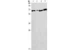 Gel: 12%SDS-PAGE, Lysate: 40 