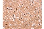 The image on the left is immunohistochemistry of paraffin-embedded Human brain tissue using CSB-PA987804(ENPP4 Antibody) at dilution 1/15, on the right is treated with synthetic peptide. (Original magnification: 
